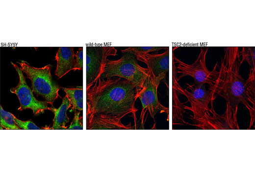 Immunofluorescence Image 1: Tuberin/TSC2 (D93F12) XP® Rabbit mAb