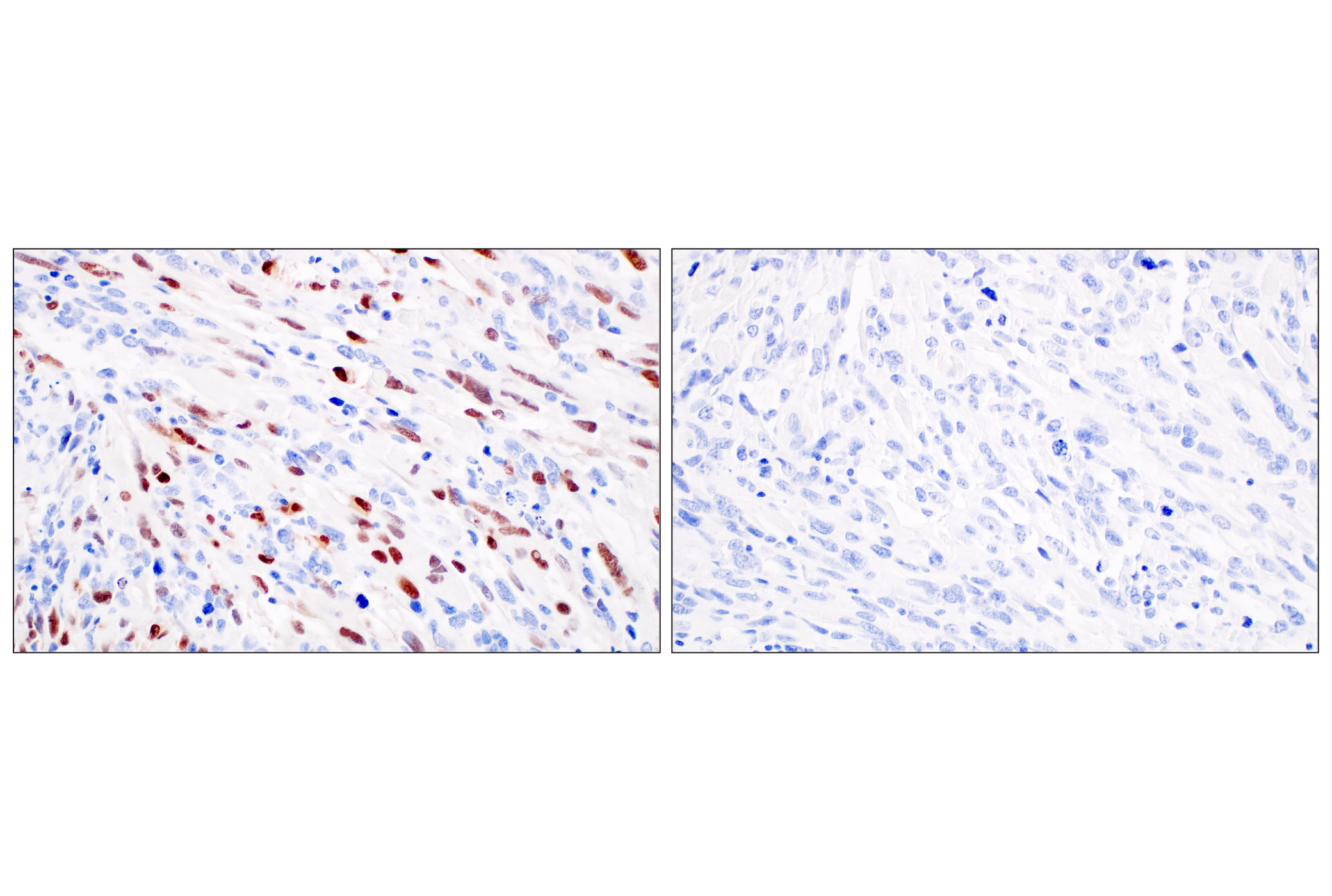 Immunohistochemistry Image 4: Myogenin (E9A1S) Rabbit mAb
