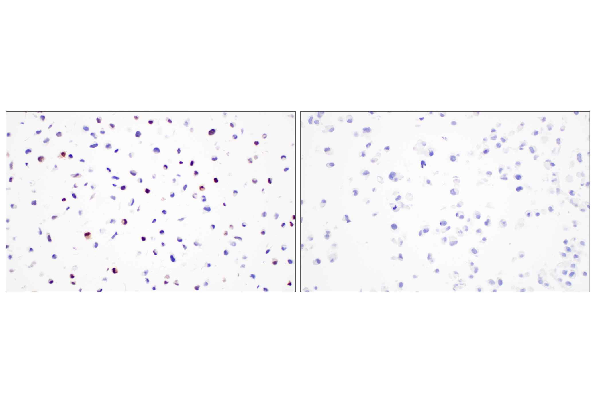 Immunohistochemistry Image 5: Myogenin (E9A1S) Rabbit mAb