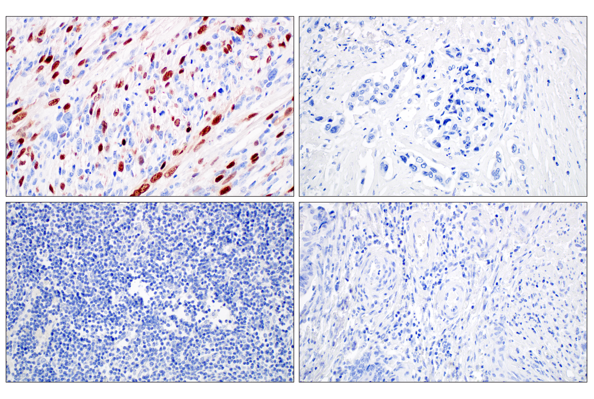 Immunohistochemistry Image 3: Myogenin (E9A1S) Rabbit mAb
