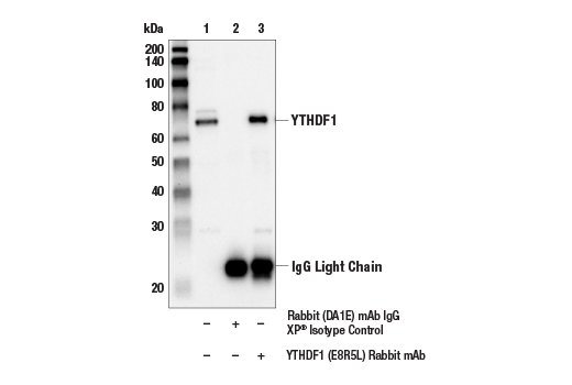 Immunoprecipitation Image 1: YTHDF1 (E8R5L) Rabbit mAb