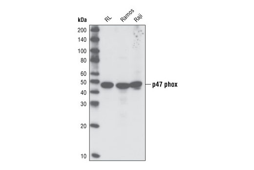 Western Blotting Image 1: p47phox Antibody