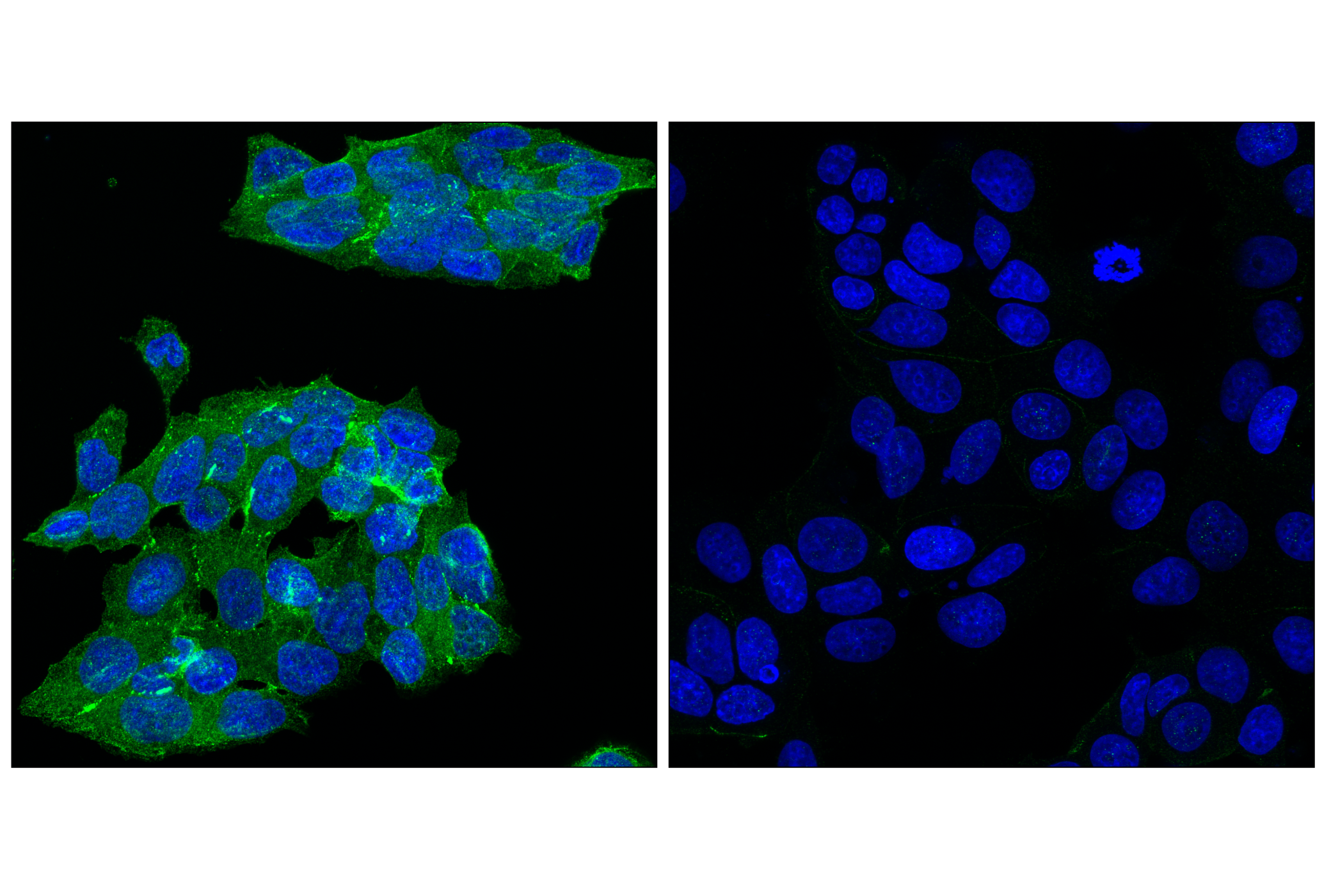 Immunofluorescence Image 1: Angiomotin (D2O4H) Rabbit mAb