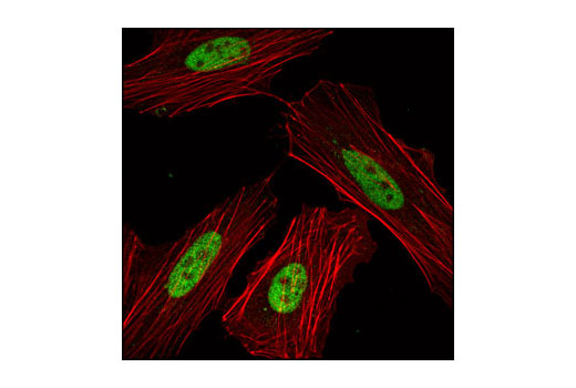 Immunofluorescence Image 1: Skp2 (L70) Antibody