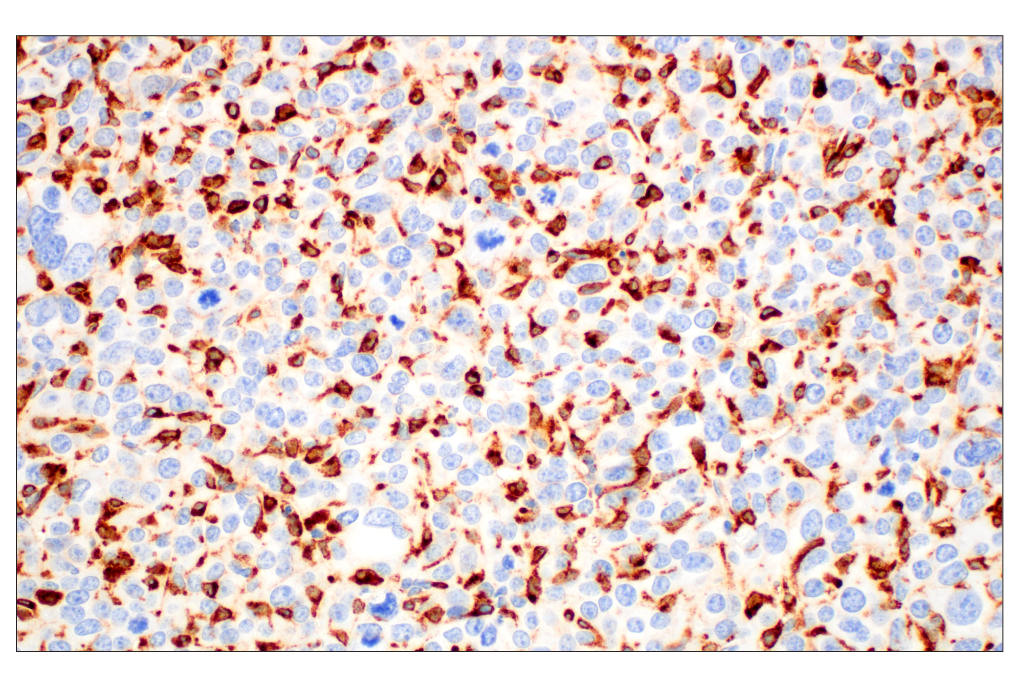 Immunohistochemistry Image 1: C1QB (E3U6X) Rabbit mAb (BSA and Azide Free)