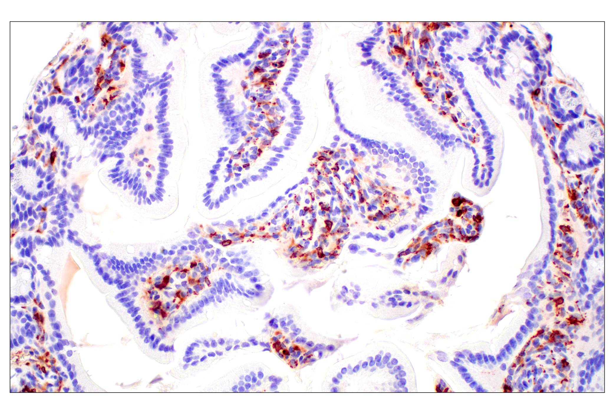Immunohistochemistry Image 4: C1QB (E3U6X) Rabbit mAb (BSA and Azide Free)
