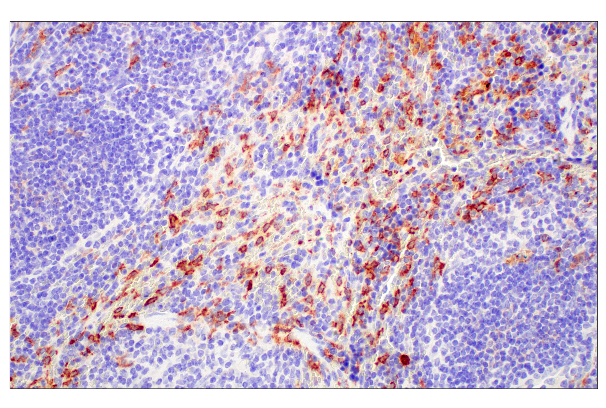 Immunohistochemistry Image 8: C1QB (E3U6X) Rabbit mAb (BSA and Azide Free)