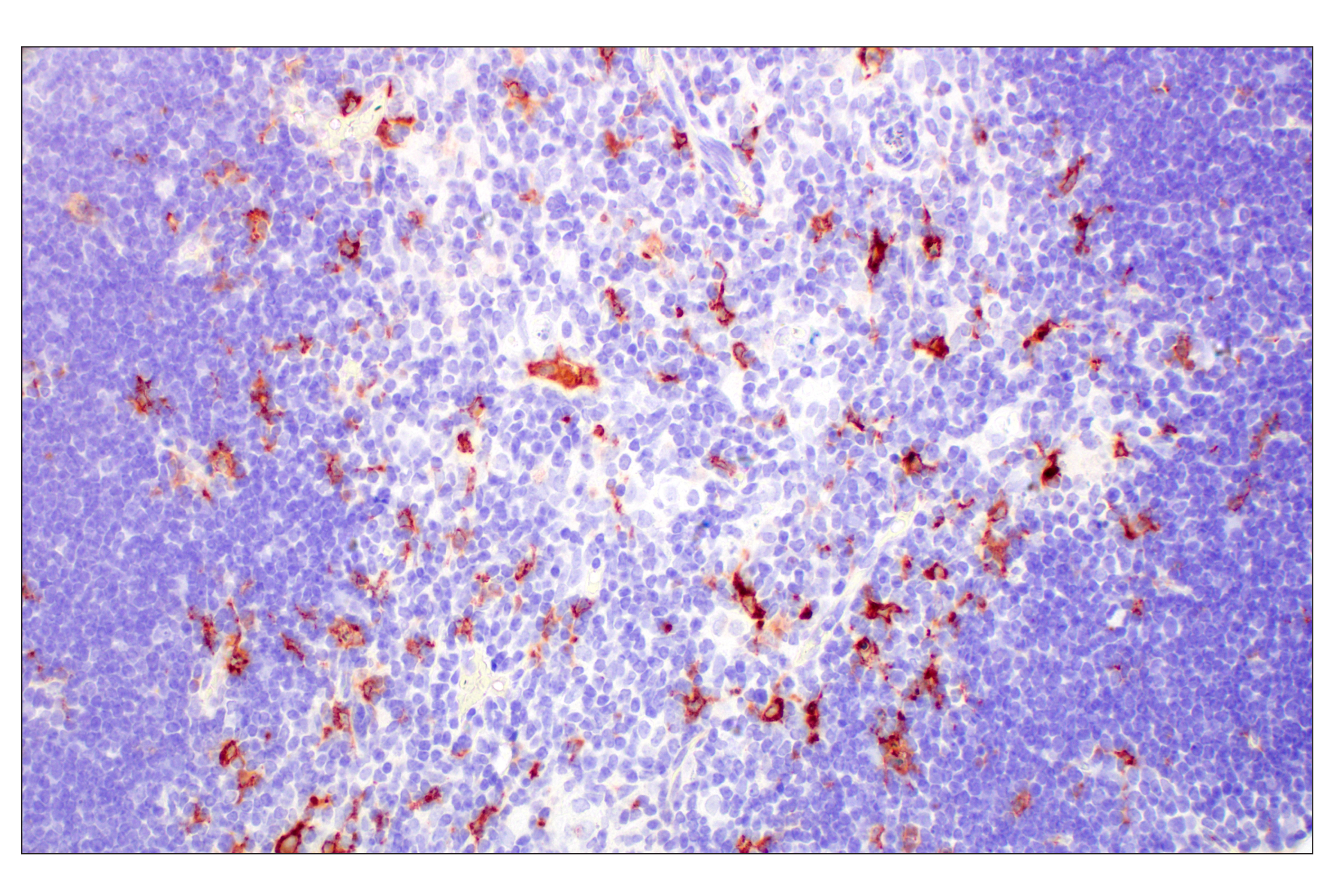 Immunohistochemistry Image 5: C1QB (E3U6X) Rabbit mAb (BSA and Azide Free)
