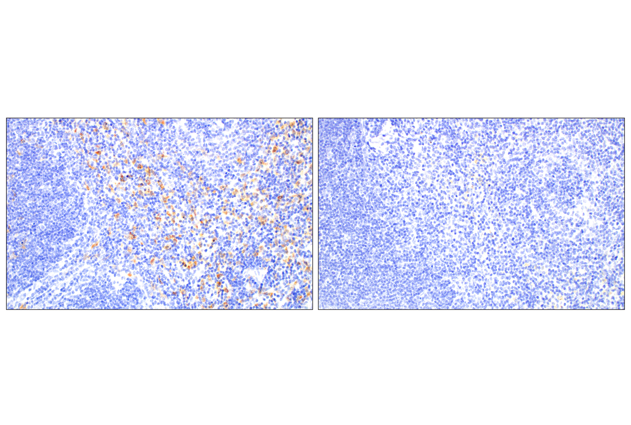 Immunohistochemistry Image 9: C1QB (E3U6X) Rabbit mAb (BSA and Azide Free)