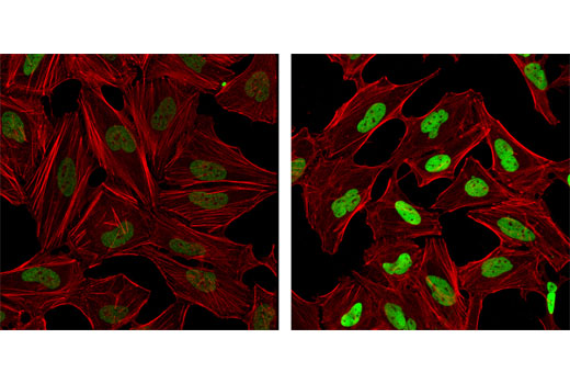 Immunofluorescence Image 1: Acetyl-Histone H3 (Lys14) Antibody