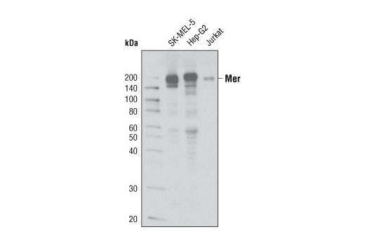  Image 1: Tyro/Axl/Mer Activation Antibody Sampler Kit