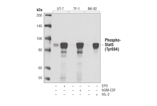  Image 1: PhosphoPlus® Stat5 (Tyr694) Antibody Duet