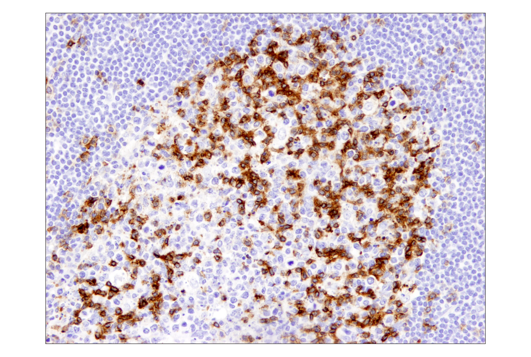 Immunohistochemistry Image 3: PD-1 (EH33) Mouse mAb