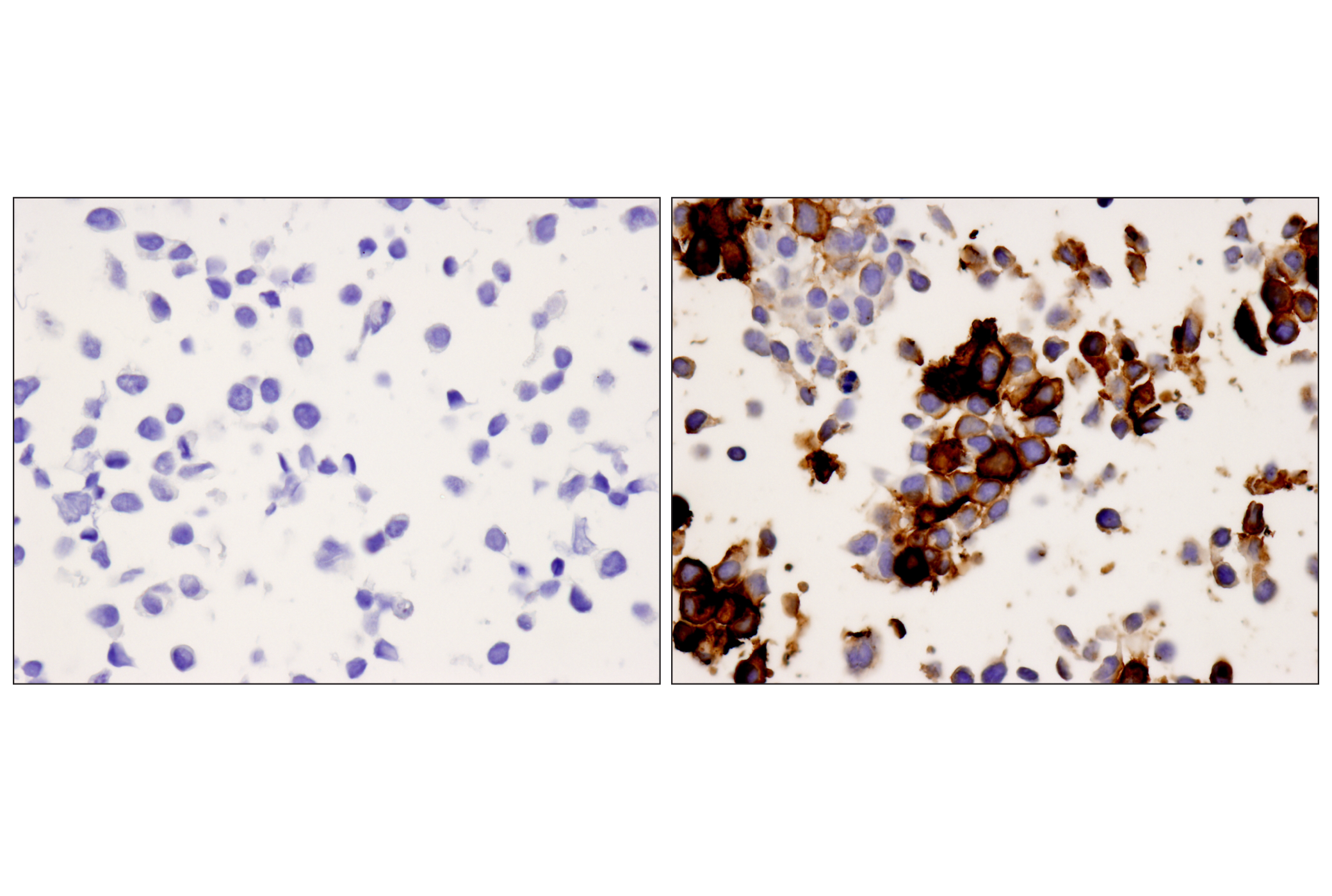 Immunohistochemistry Image 4: PD-1 (EH33) Mouse mAb
