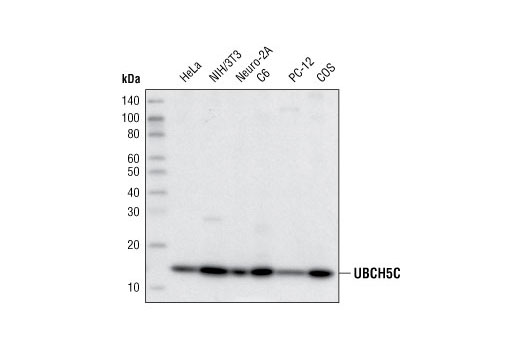  Image 2: Ubiquitin Activation (E1, E2 Enzymes) Antibody Sampler Kit