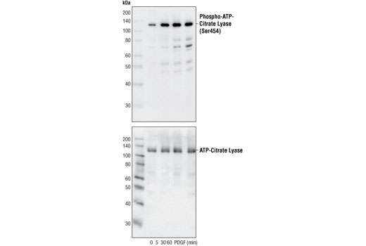 Western Blotting Image 1: Phospho-ATP-Citrate Lyase (Ser455) Antibody