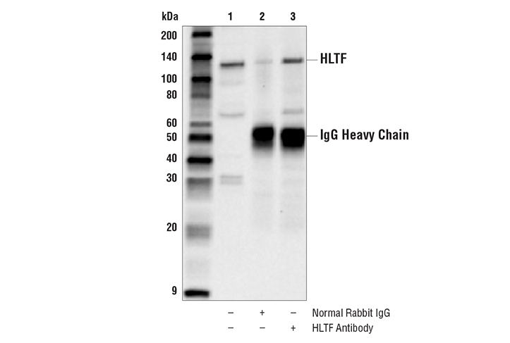 Immunoprecipitation Image 1: HLTF Antibody