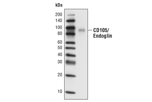 Western Blotting Image 1: CD105/Endoglin (D50G1) Rabbit mAb