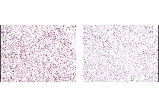 Immunohistochemistry Image 1: AML1 (D33G6) XP® Rabbit mAb (BSA and Azide Free)