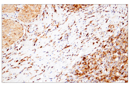 Immunohistochemistry Image 4: CD38 (E7Z8C) XP® Rabbit mAb (BSA and Azide Free)