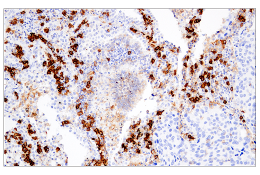 Immunohistochemistry Image 5: CD38 (E7Z8C) XP® Rabbit mAb (BSA and Azide Free)