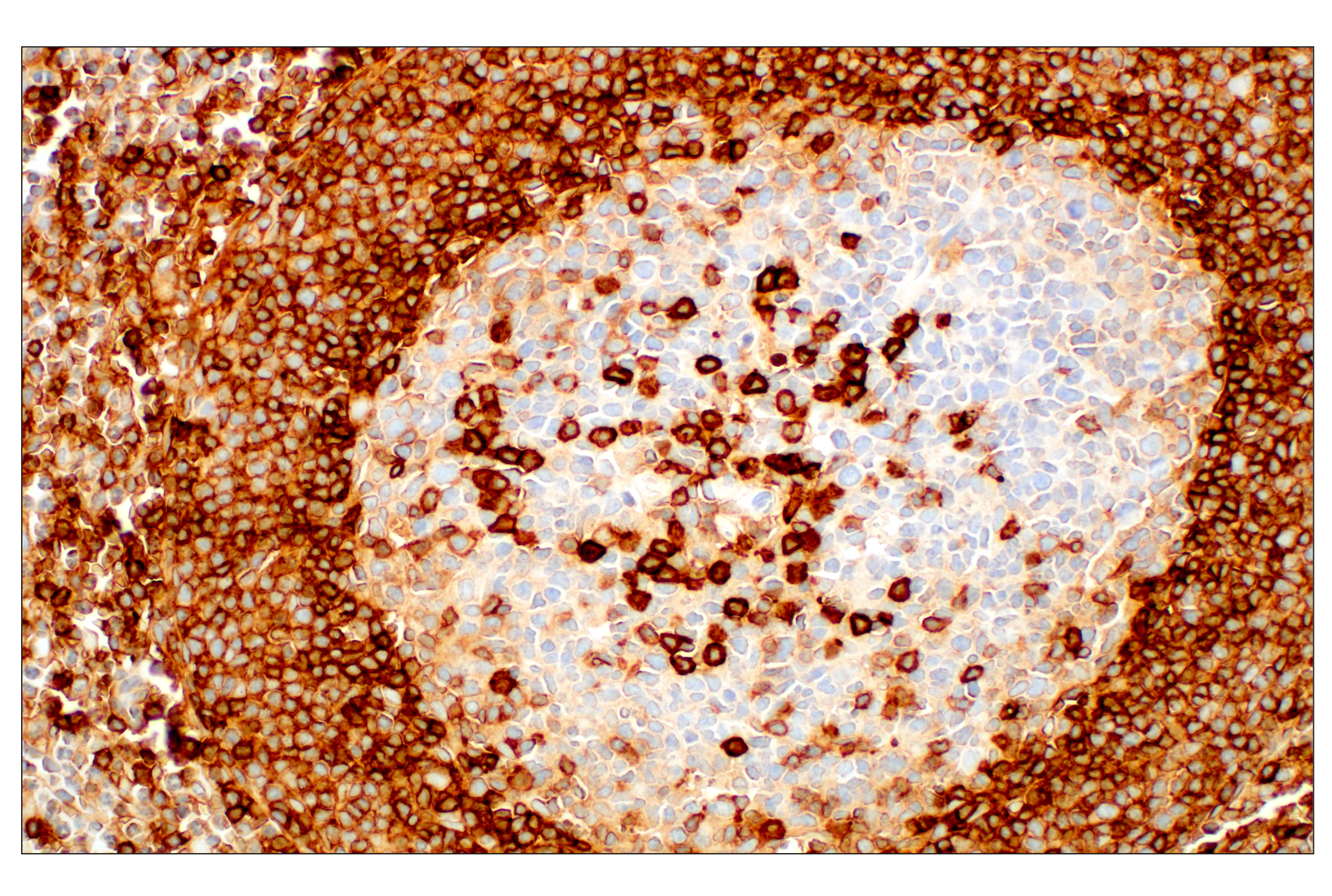Immunohistochemistry Image 10: CD38 (E7Z8C) XP® Rabbit mAb (BSA and Azide Free)
