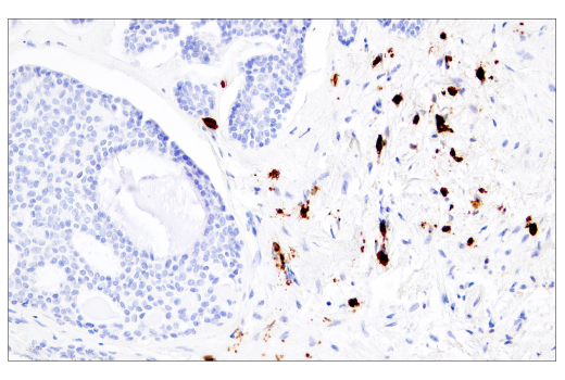 Immunohistochemistry Image 6: CD38 (E7Z8C) XP® Rabbit mAb (BSA and Azide Free)