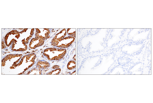 Immunohistochemistry Image 11: CD38 (E7Z8C) XP® Rabbit mAb (BSA and Azide Free)