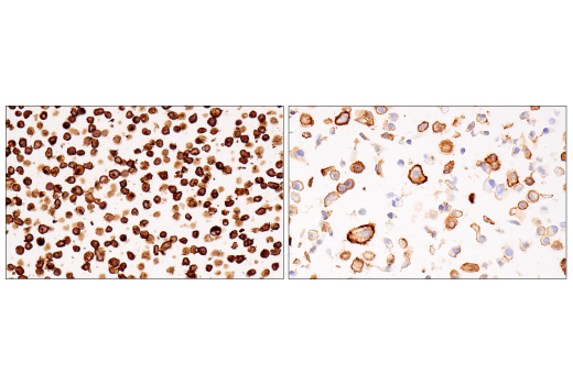 Immunohistochemistry Image 9: CD38 (E7Z8C) XP® Rabbit mAb (BSA and Azide Free)