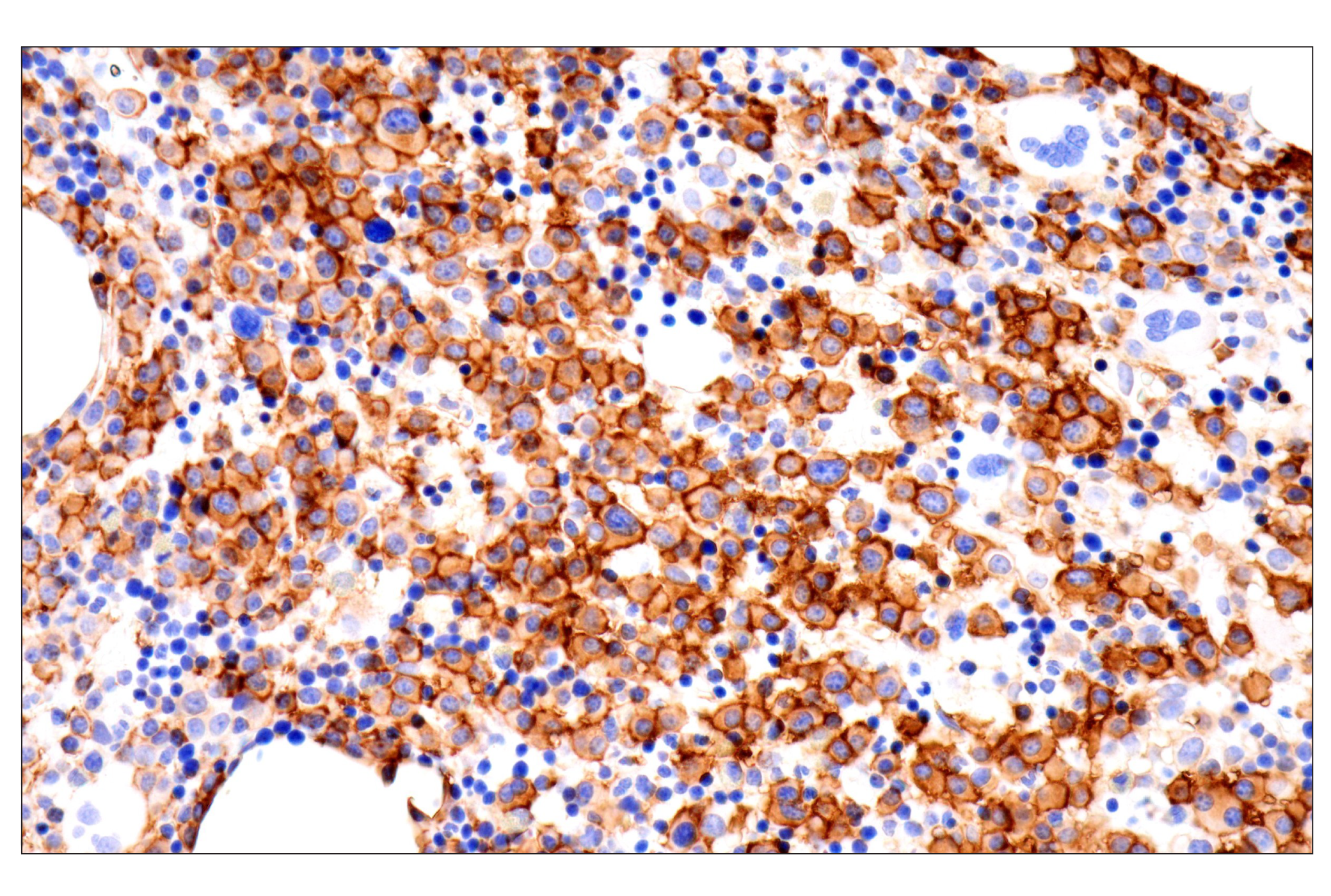 Immunohistochemistry Image 3: CD38 (E7Z8C) XP® Rabbit mAb (BSA and Azide Free)