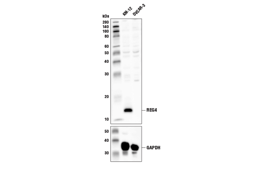 Western Blotting Image 1: REG4 Antibody