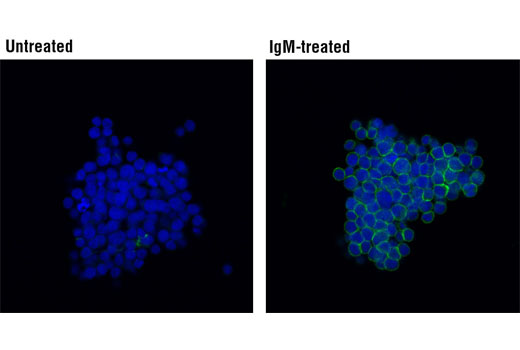 Immunofluorescence Image 1: Phospho-Syk (Tyr525/526) (C87C1) Rabbit mAb (Alexa Fluor® 488 Conjugate)
