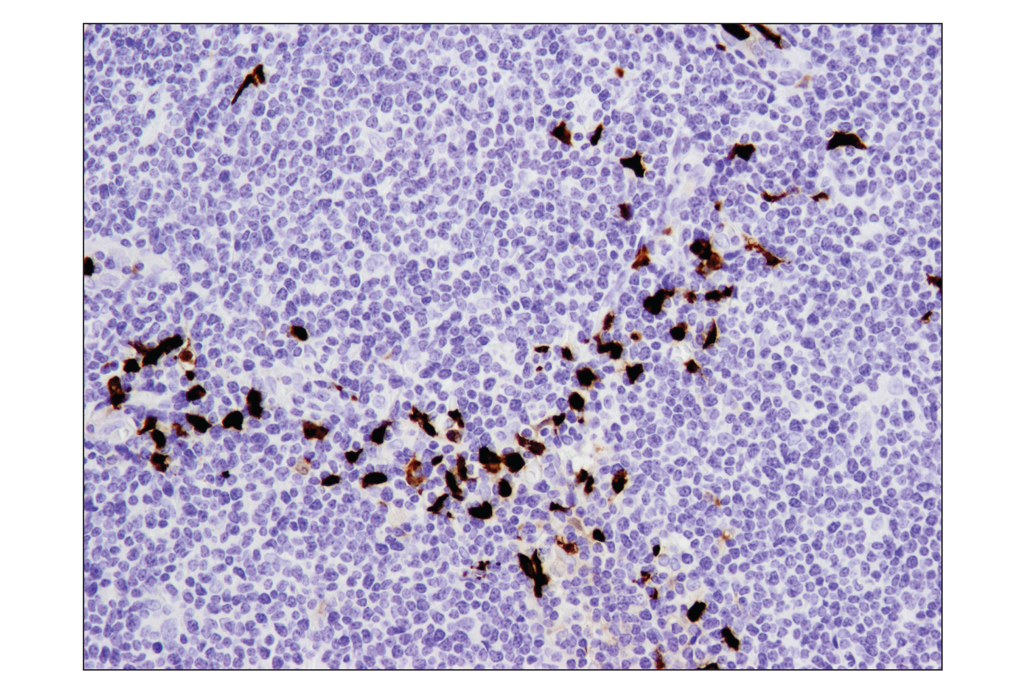 Immunohistochemistry Image 4: S100A9 (D5O6O) Rabbit mAb (BSA and Azide Free)
