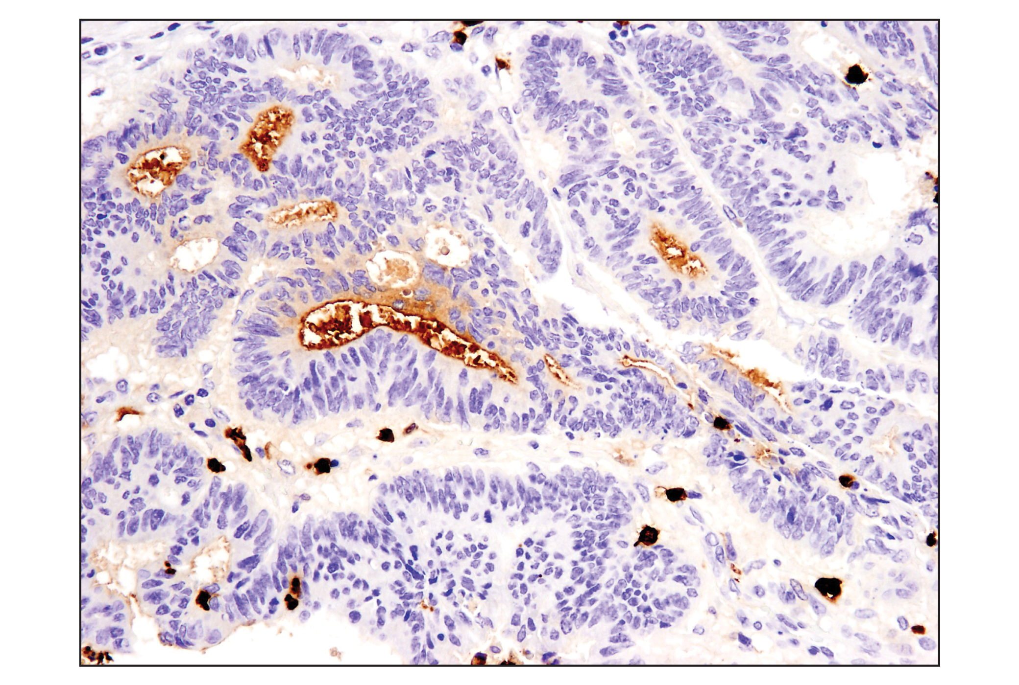Immunohistochemistry Image 1: S100A9 (D5O6O) Rabbit mAb (BSA and Azide Free)