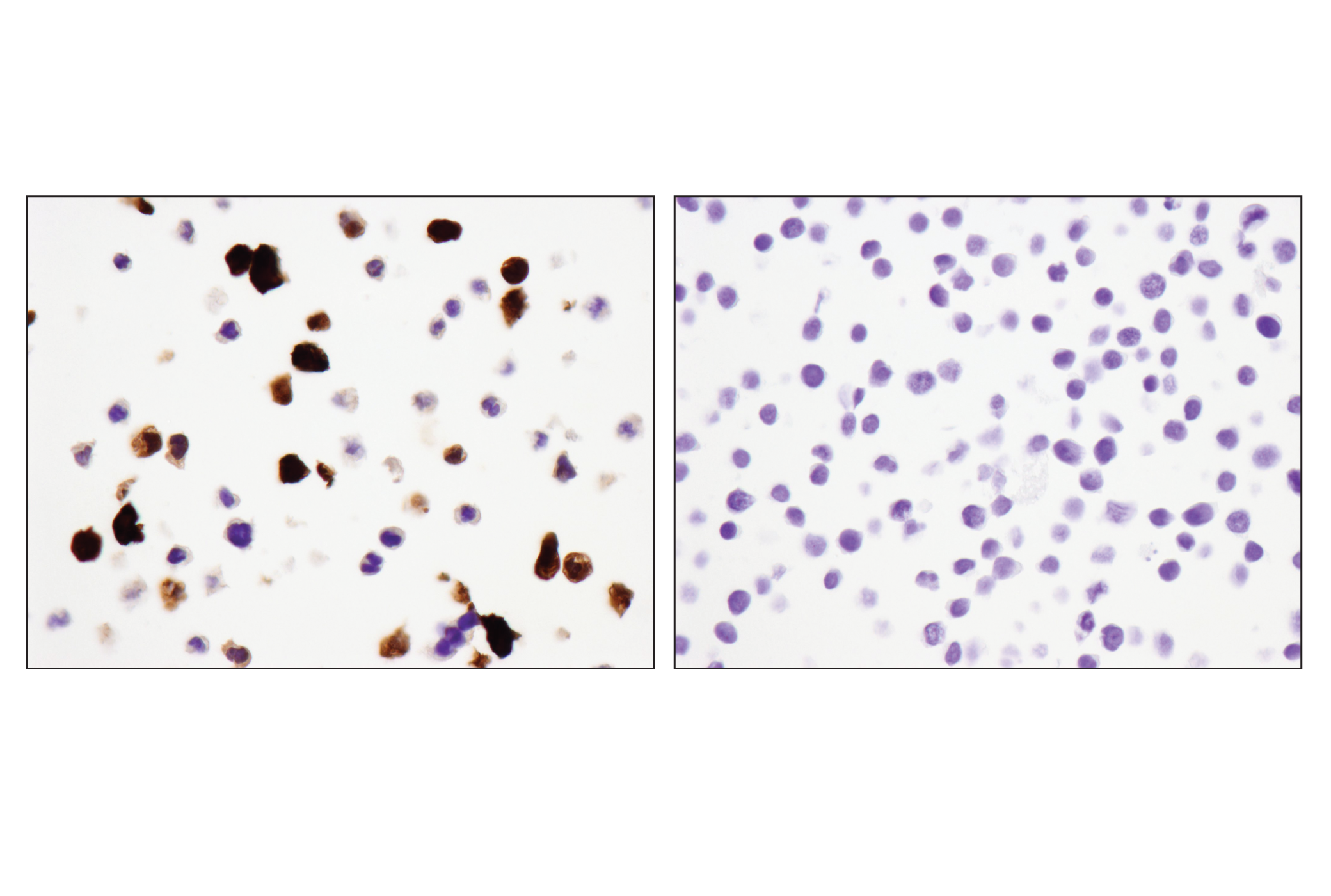 Immunohistochemistry Image 6: S100A9 (D5O6O) Rabbit mAb (BSA and Azide Free)