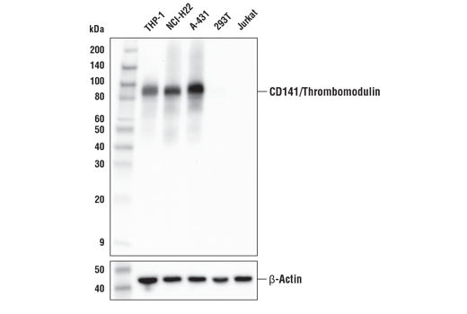 Western Blotting Image 1: CD141/Thrombomodulin (E7Y9P) XP® Rabbit mAb