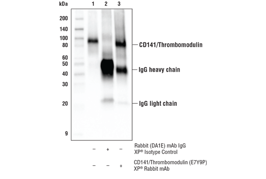 Immunoprecipitation Image 1: CD141/Thrombomodulin (E7Y9P) XP® Rabbit mAb