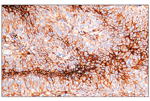 Immunohistochemistry Image 1: CD141/Thrombomodulin (E7Y9P) XP® Rabbit mAb