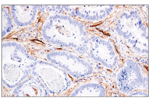 Immunohistochemistry Image 3: CD141/Thrombomodulin (E7Y9P) XP®Rabbit mAb