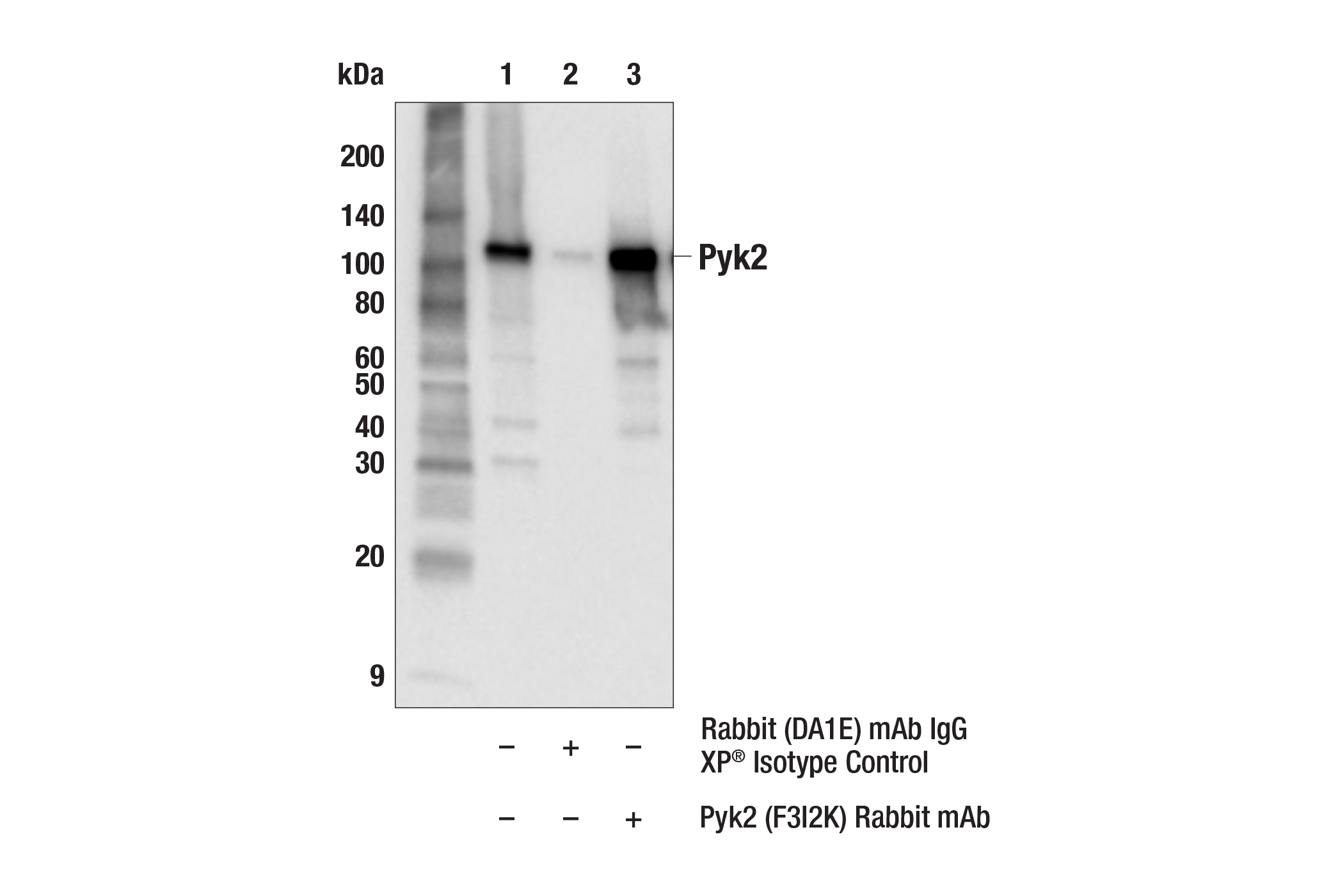 Immunoprecipitation Image 1: Pyk2 (F3I2K) Rabbit mAb