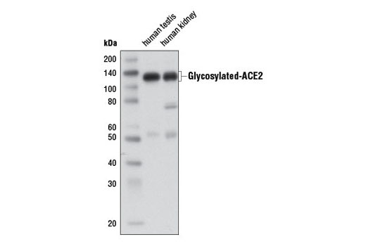  Image 19: Coronavirus Host Cell Attachment and Entry Antibody Sampler Kit