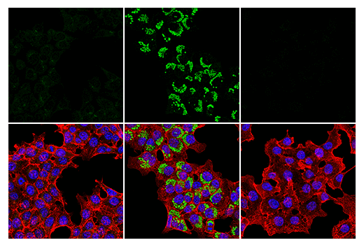Immunofluorescence Image 1: LC3B (E7X4S) XP® Rabbit mAb