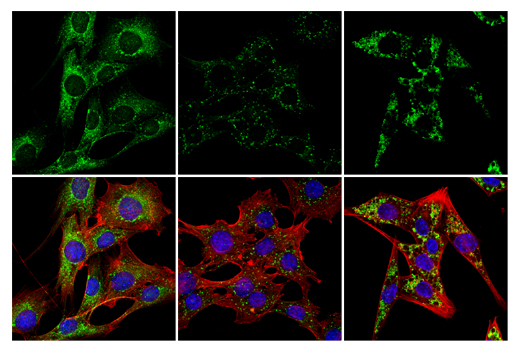 Immunofluorescence Image 3: LC3B (E7X4S) XP® Rabbit mAb