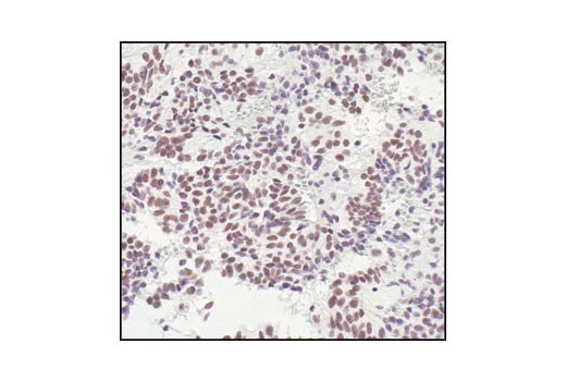 Immunohistochemistry Image 2: HSF1 Antibody