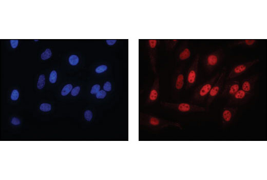Immunofluorescence Image 1: HSF1 Antibody