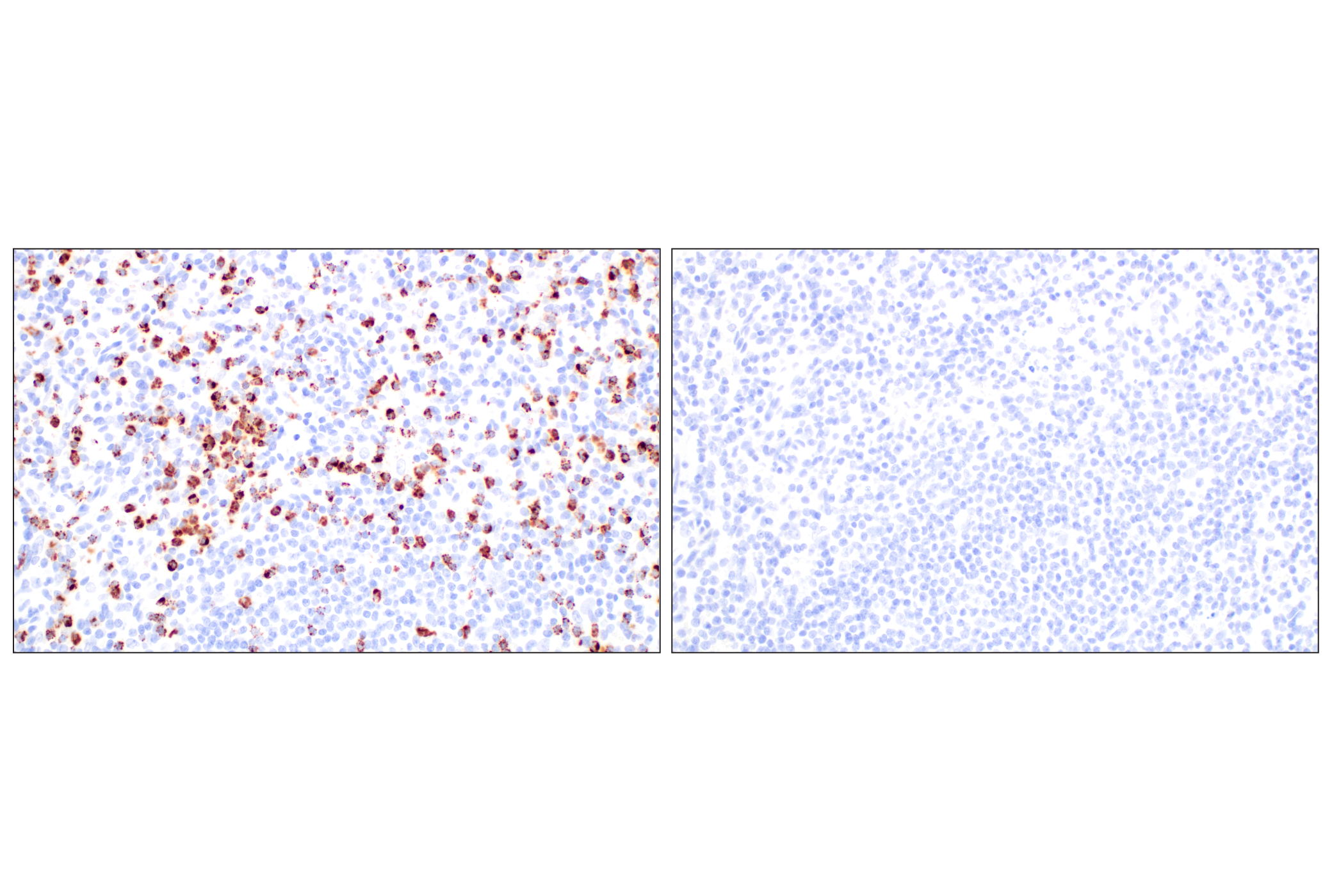 Immunohistochemistry Image 10: NKG7 (F4V5I) Rabbit mAb (BSA and Azide Free)