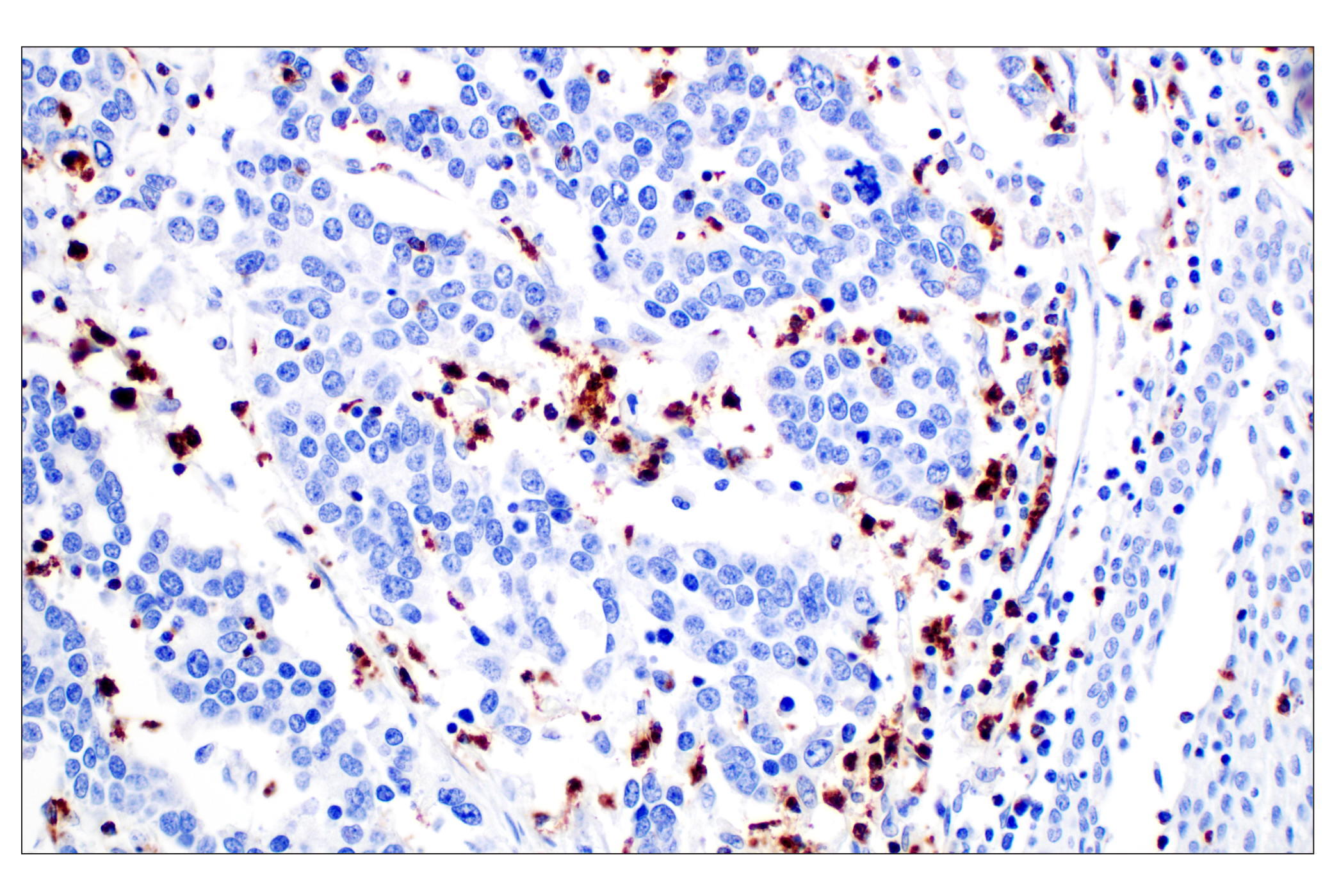 Immunohistochemistry Image 4: NKG7 (F4V5I) Rabbit mAb (BSA and Azide Free)