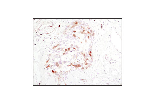  Image 6: PhosphoPlus® p44/42 MAPK (Erk1/2) (Thr202/Tyr204) Antibody Duet