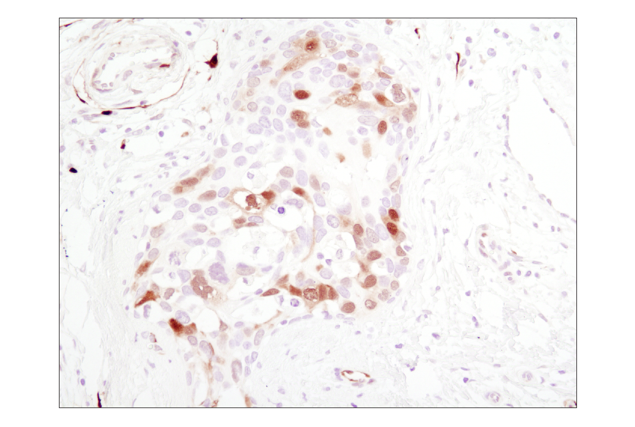 Immunohistochemistry Image 1: Phospho-p44/42 MAPK (Erk1/2) (Thr202/Tyr204) (D13.14.4E) XP® Rabbit mAb