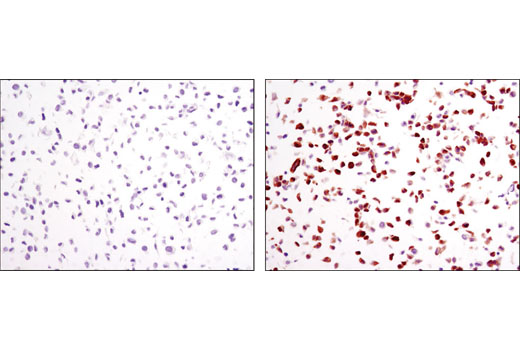  Image 10: PhosphoPlus® p44/42 MAPK (Erk1/2) (Thr202/Tyr204) Antibody Duet